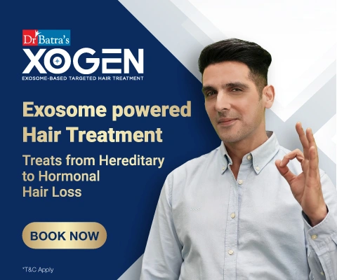 Exosome hair treatment