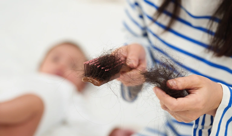 Dealing with Postpartum Hair Loss