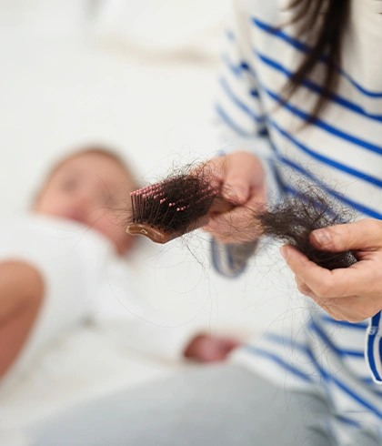 Dealing with Postpartum Hair Loss