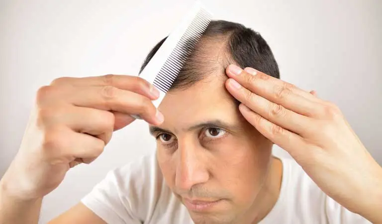 hard water really cause hair loss