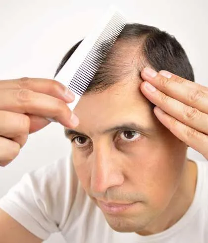 hard water really cause hair loss